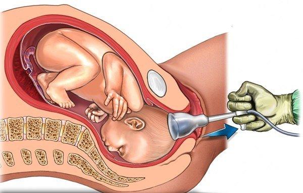⚕️Bỏ thai an toàn, hạn chế biến chứng tại phòng khám