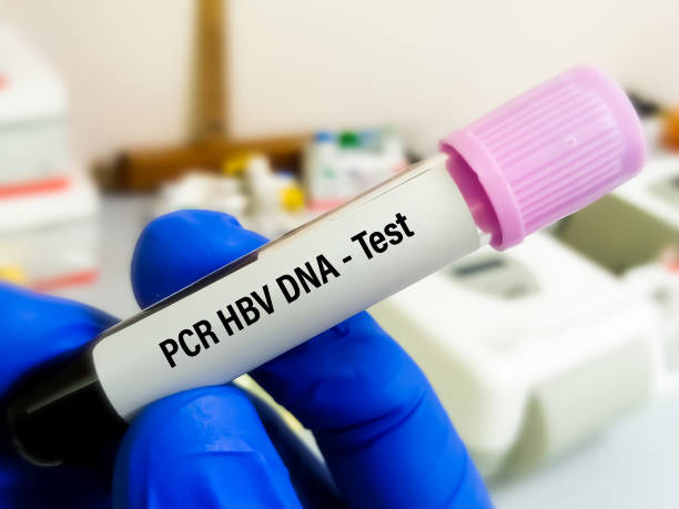 ⚕️Xét Nghiệm HBV-DNA Và Những Điều Cần Biết